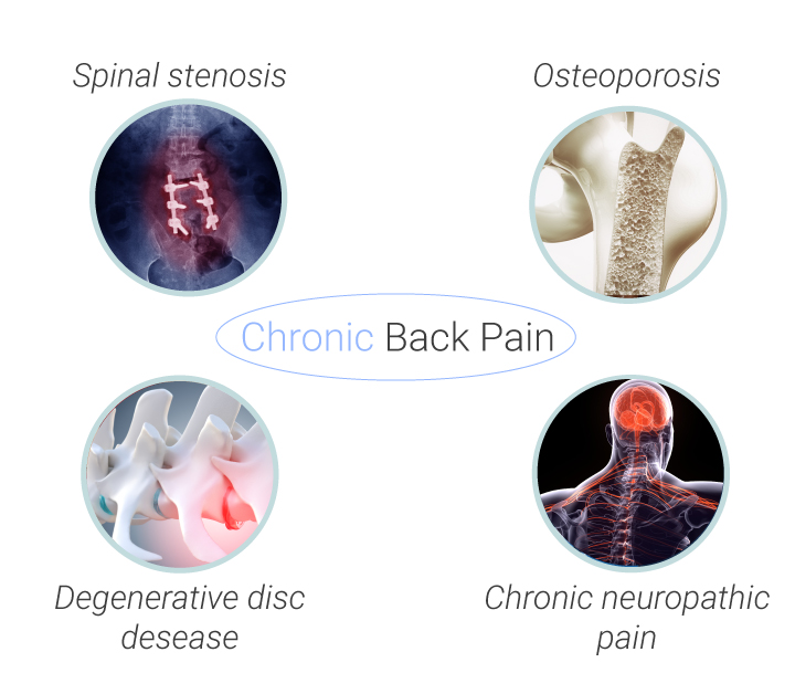 Common Causes and Types of Back Pain Common Causes and Types of Back Pain